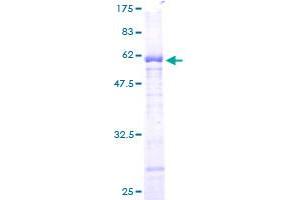 Image no. 1 for Protein Phosphatase 1, Regulatory Subunit 3B (PPP1R3B) (AA 1-285) protein (GST tag) (ABIN1315991) (PPP1R3B Protein (AA 1-285) (GST tag))