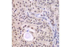 Immunohistochemistry (Paraffin-embedded Sections) (IHC (p)) image for anti-DEAD (Asp-Glu-Ala-Asp) Box Polypeptide 5 (DDX5) (AA 1-614) antibody (ABIN6139505)