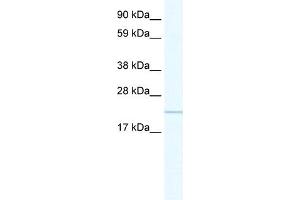 WB Suggested Anti-GTL3 Antibody Titration:  0. (C16orf80 Antikörper  (C-Term))