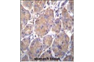 Immunohistochemistry (Paraffin-embedded Sections) (IHC (p)) image for anti-Heat Shock Protein 90kDa beta (Grp94), Member 1 (HSP90B1) (AA 460-487) antibody (ABIN655868)
