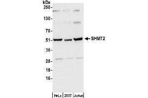 Western Blotting (WB) image for anti-serine Hydroxymethyltransferase 2 (Mitochondrial) (SHMT2) (AA 25-75) antibody (ABIN7450728)