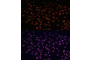 Immunofluorescence analysis of C6 cells using CHD4 antibody (ABIN6127308, ABIN6138512, ABIN6138513 and ABIN6215263) at dilution of 1:100.
