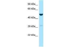 WB Suggested Anti-GALK2 Antibody Titration: 1.