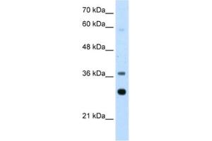 Western Blotting (WB) image for anti-Ribosomal Protein, Large, P0 (RPLP0) antibody (ABIN2462059) (RPLP0 Antikörper)