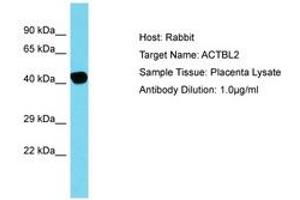 Image no. 1 for anti-Actin, beta-Like 2 (ACTBL2) (C-Term) antibody (ABIN6750797) (ACTBL2 Antikörper  (C-Term))