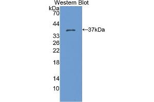 Western blot analysis of the recombinant protein. (KRT15 Antikörper  (AA 94-402))