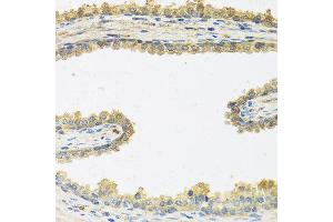 Immunohistochemistry of paraffin-embedded human prostate using CRHBP antibody at dilution of 1:100 (40x lens). (CRHBP Antikörper)
