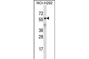 ODF2L Antibody (C-term) (ABIN656938 and ABIN2846129) western blot analysis in NCI- cell line lysates (35 μg/lane). (ODF2L Antikörper  (C-Term))