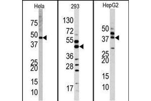 Western blot analysis of anti-PK1 Antibody (Center) Pab (R) in Hela, 293, and HepG2 cell line lysates.