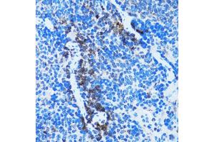Immunohistochemistry of paraffin-embedded rat spleen using CASP3 antibody (ABIN4903140) at dilution of 1:100 (40x lens).