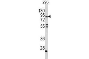 Western blot analysis of CCHCR1 Antibody (Center) in 293 cell line lysates (35ug/lane).