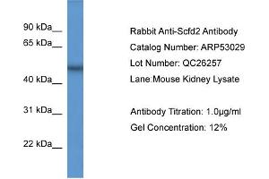 WB Suggested Anti-Scfd2  Antibody Titration: 0. (SCFD2 Antikörper  (Middle Region))