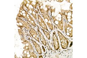 Immunohistochemistry of paraffin-embedded mouse intestin using TOPBP1 Rabbit pAb (ABIN6129493, ABIN6149398, ABIN6149401 and ABIN6221465) at dilution of 1:50 (40x lens).