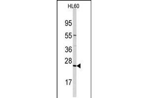 Western blot analysis of anti-TRAPPC4 Antibody in HL60 cell line lysates (35ug/lane) (TRAPPC4 Antikörper  (N-Term))
