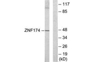 Western blot analysis of extracts from HeLa cells, using ZNF174 Antibody. (ZNF174 Antikörper  (AA 201-250))