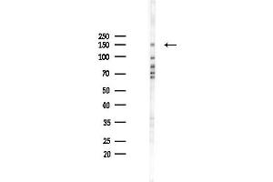 Western blot analysis of lysates from A2780 cells(starvation 24h treatment), using NCAPD3 Antibody at 1/1000 dilution.