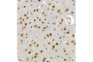 Immunohistochemistry of paraffin embedded rat brain using UBE3A (ABIN7076104) at dilution of 1:1000 (400x lens) (ube3a Antikörper)