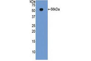 Western Blotting (WB) image for Integrin beta 2 (ITGB2) ELISA Kit (ABIN6574283)