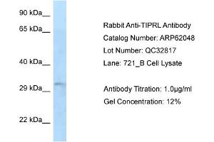 Western Blotting (WB) image for anti-TIP41-like protein (TIPRL) (N-Term) antibody (ABIN2788999) (TIPRL Antikörper  (N-Term))