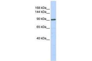 Image no. 1 for anti-General Transcription Factor IIIC, Polypeptide 3, 102kDa (GTF3C3) (AA 36-85) antibody (ABIN6742818) (GTF3C3 Antikörper  (AA 36-85))