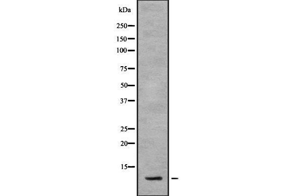 SNAPC5 Antikörper  (Internal Region)