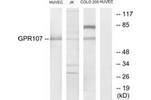 Western blot analysis of extracts from HuvEc/Jurkat/COLO205 cells, using GPR107 Antibody. (GPR107 Antikörper  (AA 141-190))