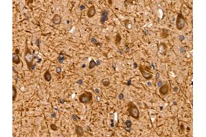 ABIN6259869 and ABIN6267009 at 1/100 staining Rat brain tissue by IHC-P. (AKT 1/2/3 Antikörper  (C-Term, pan))