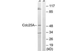 Western blot analysis of extracts from Jurkat cells, using CDC25A (Ab-178) Antibody. (CDC25A Antikörper  (AA 144-193))