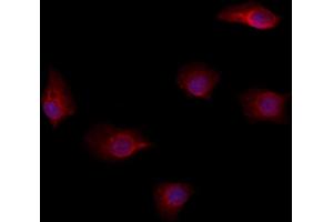 ABIN6264573 and ABIN6278624 staining Hela by IF/ICC. (RAB35 Antikörper  (Internal Region))