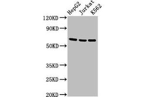 Western Blot Positive WB detected in: HepG2 whole cell lysate, Jurkat whole cell lysate, K562 whole cell lysate All lanes: TNFRSF9 antibody at 2. (CD137 Antikörper  (AA 24-186))