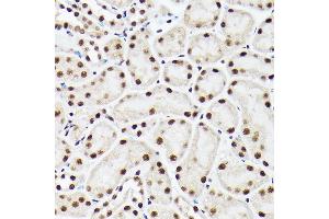 Immunohistochemistry of paraffin-embedded mouse kidney using A Rabbit pAb (ABIN6129868, ABIN6136479, ABIN6136480 and ABIN6221034) at dilution of 1:100 (40x lens). (BAF53A Antikörper  (AA 1-280))