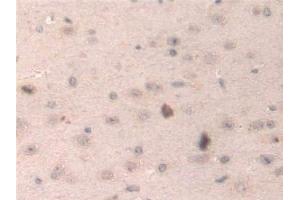 Immunohistochemistry (IHC) image for anti-Hermansky-Pudlak Syndrome 4 (HPS4) (AA 20-214) antibody (ABIN7443896)