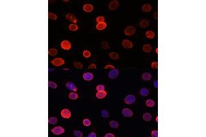 Immunofluorescence analysis of C6 cells using SUN2 antibody (ABIN7270136) at dilution of 1:100. (SUN2 Antikörper)