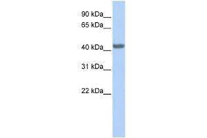 WB Suggested Anti-CCR2 Antibody Titration: 0. (CCR2 Antikörper  (Middle Region))
