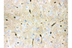 Immunohistochemistry (IHC) image for anti-Aquaporin 4 (AQP4) (AA 295-323), (C-Term) antibody (ABIN3043789)