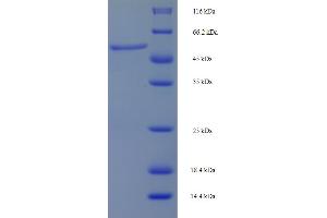 SDS-PAGE (SDS) image for Mitogen-Activated Protein Kinase Kinase 6 (MAP2K6) (AA 1-334), (full length) protein (His-SUMO Tag) (ABIN5709901) (MAP2K6 Protein (AA 1-334, full length) (His-SUMO Tag))