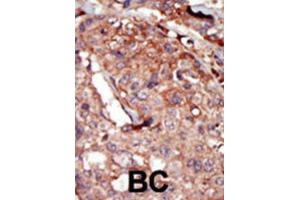 Immunohistochemistry (IHC) image for anti-Bromodomain Containing 2 (BRD2) antibody (ABIN3003651)