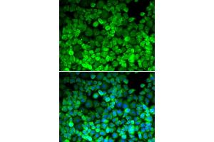 Immunofluorescence analysis of HeLa cells using TERF1 antibody. (TRF1 Antikörper)
