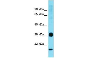 Western Blotting (WB) image for anti-RAB31, Member RAS Oncogene Family (RAB31) (Middle Region) antibody (ABIN2788973)
