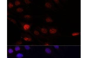 Immunofluorescence analysis of C6 cells using KLHL8 Polyclonal Antibody at dilution of 1:100. (KLHL8 Antikörper)