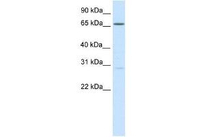 Western Blot showing NFAT5 antibody used at a concentration of 1-2 ug/ml to detect its target protein. (NFAT5 Antikörper  (Middle Region))