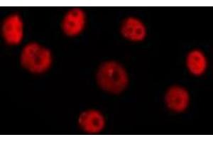 ABIN6277385 staining Hela cells by IF/ICC. (HOXC8 Antikörper  (Internal Region))