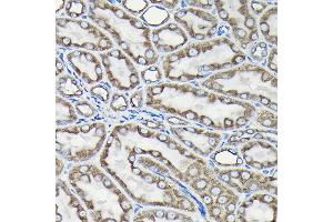 Immunohistochemistry of paraffin-embedded Rat kidney using Alpha-tubulin (ubiquitous) chain antibody (ABIN7271033) at dilution of 1:50 (40x lens). (TUBA1B Antikörper  (AA 1-451))