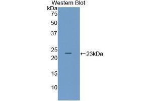 Detection of Recombinant ADCYAP1, Mouse using Polyclonal Antibody to Pituitary Adenylate Cyclase Activating Peptide (PACAP) (Pituitary Adenylate Cyclase Activating Peptide (AA 1-175) Antikörper)