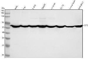 Western blot analysis of TCP1 Beta using anti-TCP1 Beta antibody (ABIN7606467).