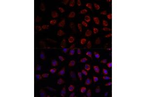 Immunofluorescence analysis of L929 cells using PDE11A antibody (ABIN7269298) at dilution of 1:100. (PDE11A Antikörper  (AA 712-933))