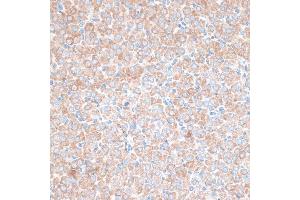 Immunohistochemistry of paraffin-embedded rat ovary using PMEP antibody (6555) at dilution of 1:100 (40x lens). (PMEPA1 Antikörper  (AA 173-252))