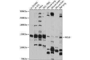 Western blot analysis of extracts of various cell lines, using NOL6 antibody (ABIN7269034) at 1:1000 dilution. (Nucleolar Protein 6 Antikörper  (AA 1032-1146))