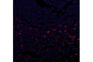 IF analysis of CXCL12 using anti-CXCL12 antibody (ABIN6719467).