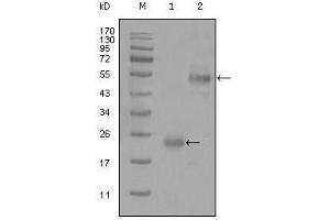 Western Blot showing CD44 antibody used against truncated Trx-CD44 recombinant protein (1) and GST-CD44 (aa628-699) recombinant protein (2). (CD44 Antikörper)